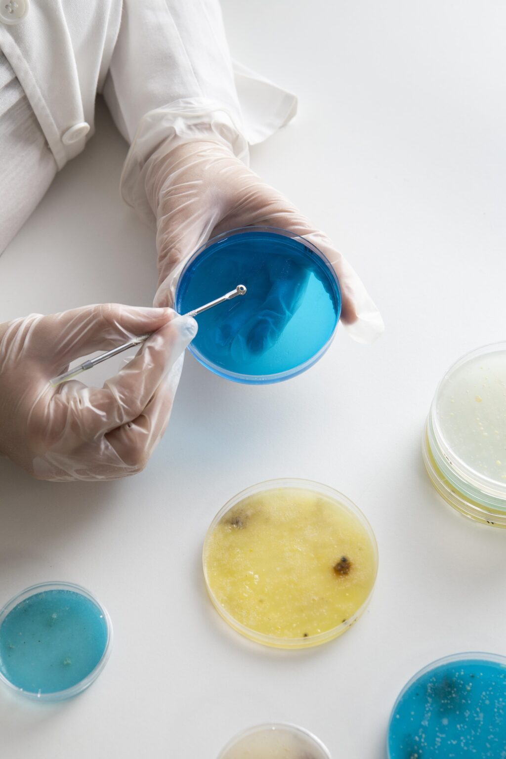 Gut Microbiome Testing: Do You Really Need One and What Can It Tell You ...